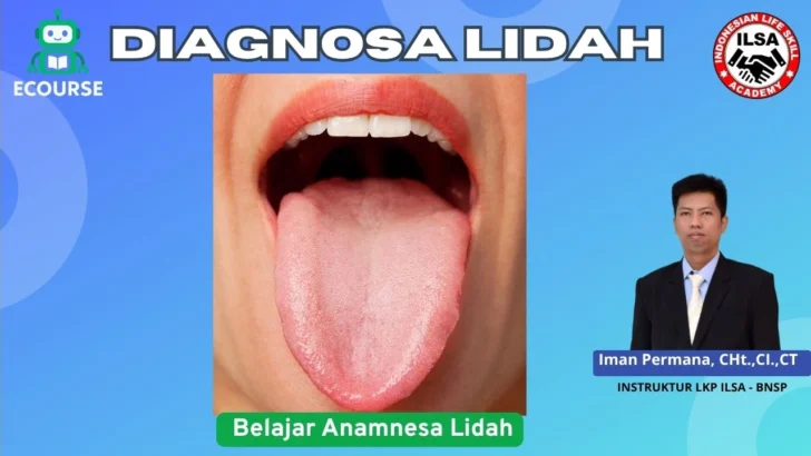 Diagnosa Lidah